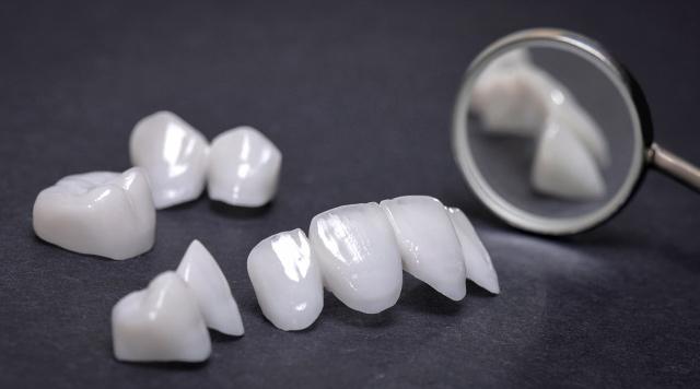 Perché scegliere lo zircone ceramica per corone e ponti dentali?